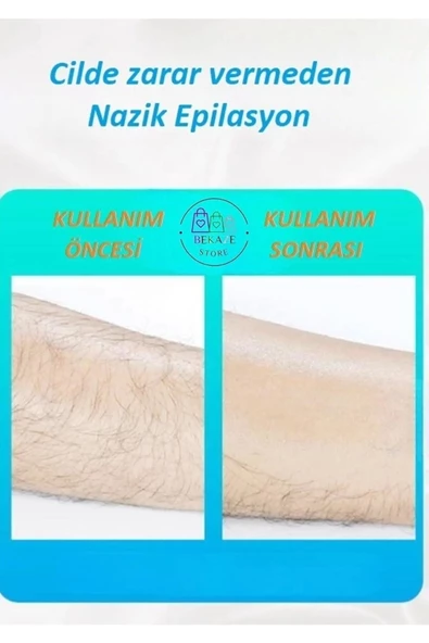 Crystal Eraser Epilasyon Aleti - 10