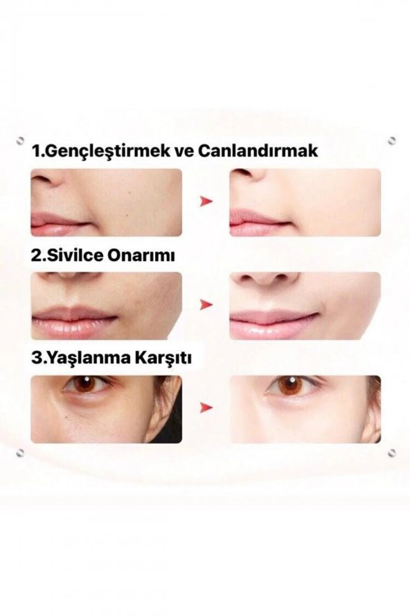 Pembe Akıllı Maske Terapi Cihazı Ve 5 Adet Maske - 3