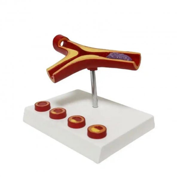 Damar Maketi Tıp Eğitim Maketi Model 47 - 2