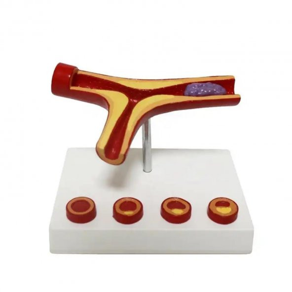 Damar Maketi Tıp Eğitim Maketi Model 47 - 3