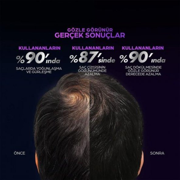 Clear Men Scalp Pro Saç Dökülmesine Karşı Güçlendirici Serum 70 ml - 6