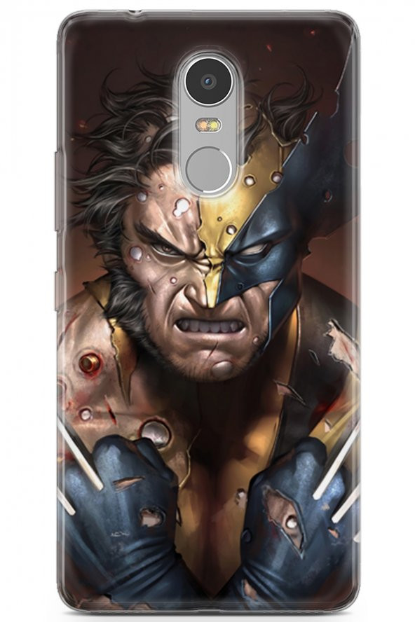 Lenovo K6 Note Uyumlu Kılıf Dc 03 Wolverine Arka Kapak Gold