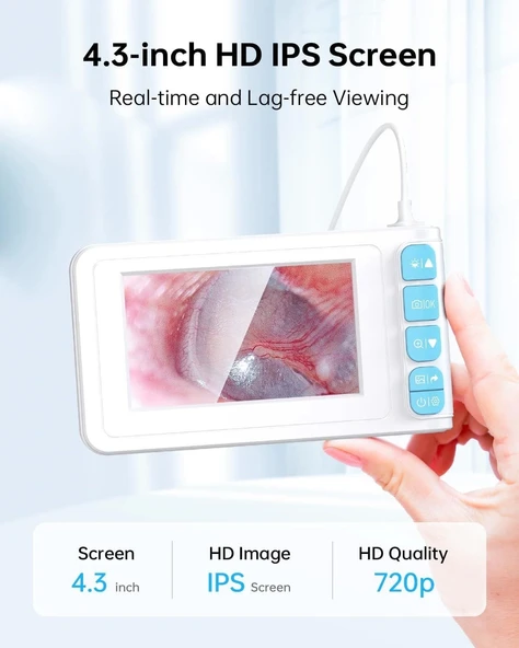 SKYEAR Işıklı Kulak Kiri Temizleme Aracı Kamerası - 4.3 Inc Ekran - 2