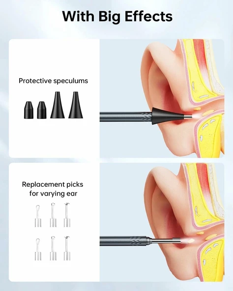 SKYEAR Işıklı Kulak Kiri Temizleme Aracı Kamerası - 4.3 Inc Ekran - 4