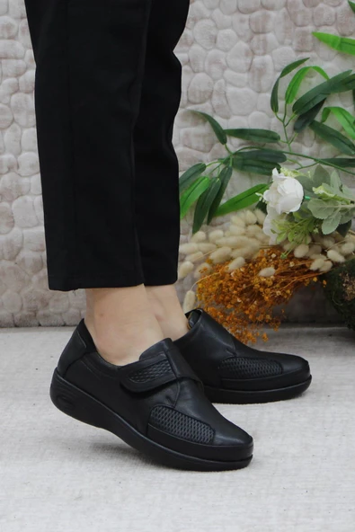 Mehmet Mete 4150 Comfort Hakiki Deri Kemik Çıkıntısına Özel Kadın Ayakkabı ürün görseli