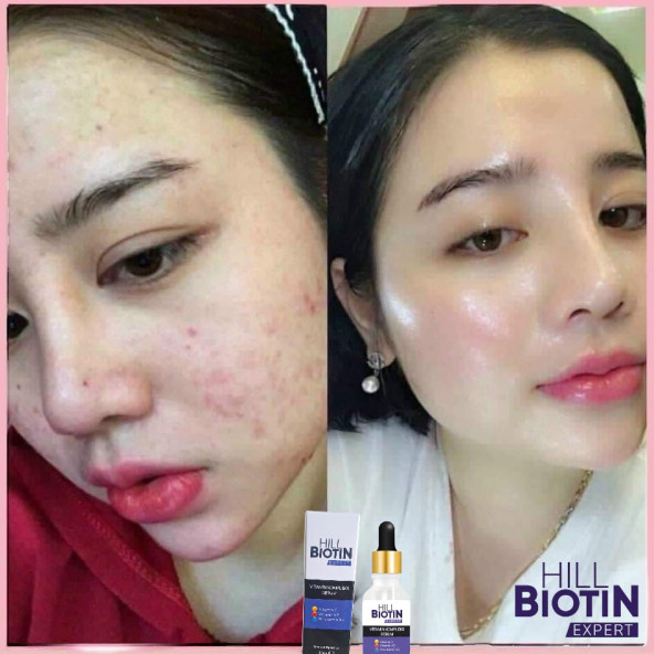 Vitamin C Leke Karşıtı&aydınlatıcı, yüz dolgunlaştırıcı,kompleks serum - 3