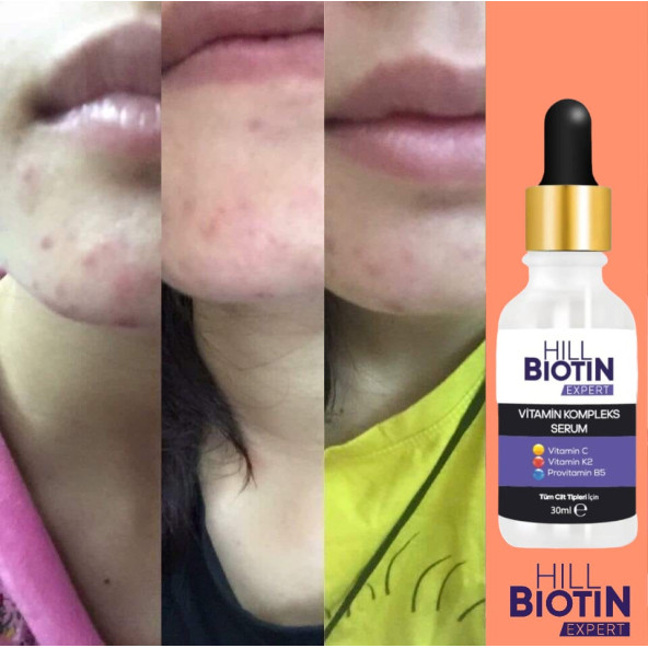 Vitamin C Leke Karşıtı&aydınlatıcı, yüz dolgunlaştırıcı,kompleks serum - 4