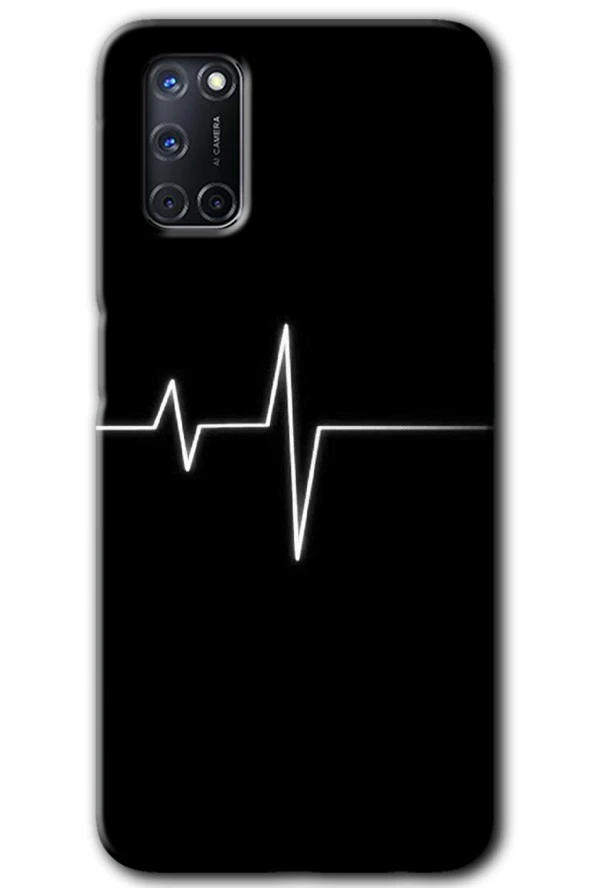 Oppo A52 Kılıf HD Desen Baskılı Arka Kapak - Heart Rytm