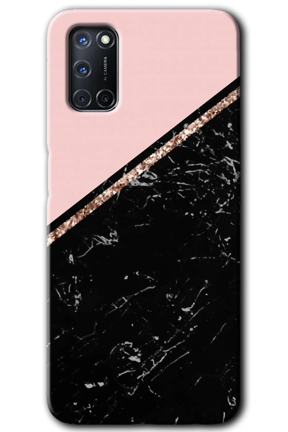 Oppo A72 Kılıf HD Desen Baskılı Arka Kapak - Yarım Mermer