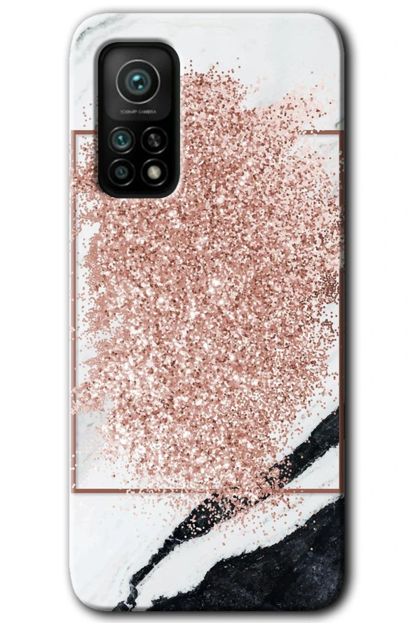 Xiaomi Mi 10T Kılıf HD Desen Baskılı Arka Kapak - Simli Mermer