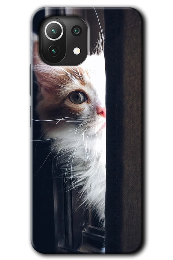 Xiaomi Mi 11 Kılıf HD Desen Baskılı Arka Kapak - Kedi Bakışı