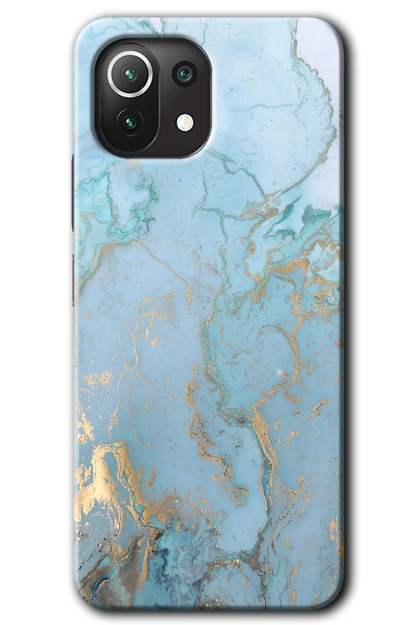 Xiaomi Mi 11 Kılıf HD Desen Baskılı Arka Kapak - Mavi Gold Mermer