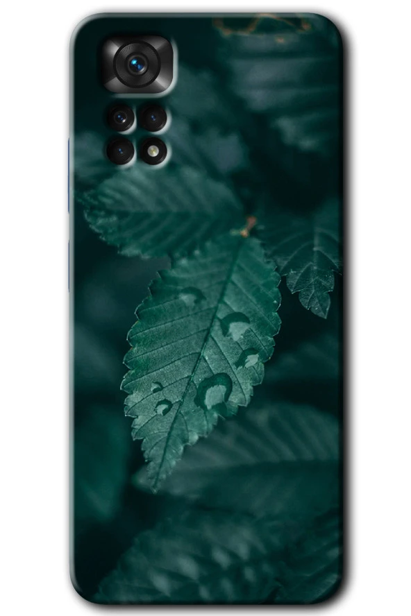 Redmi Note 11 Pro 5G Kılıf HD Desen Baskılı Arka Kapak - Yağmurlu Yaprak