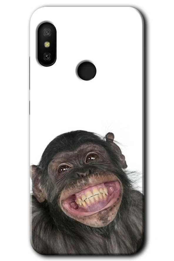 Xiaomi Mi A2 Lite Kılıf HD Desen Baskılı Arka Kapak - Şıpsevdi Aşk