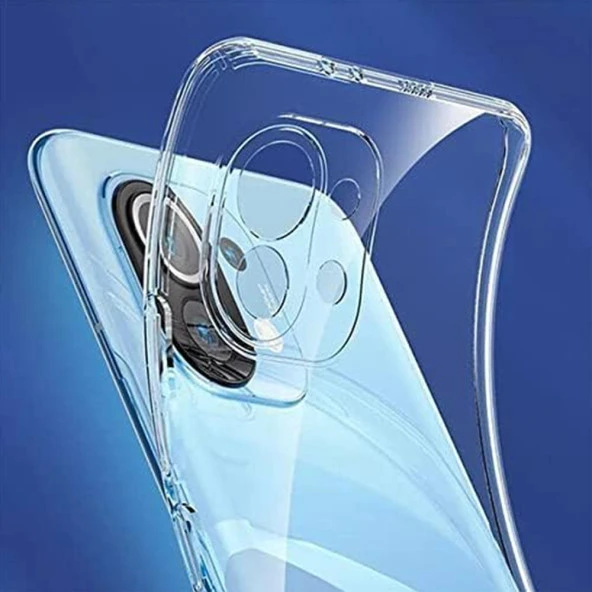 FitCase Xiaomi Mi 11 Kılıf Kamera Korumalı Silikon Şeffaf Arka Kapak - 2