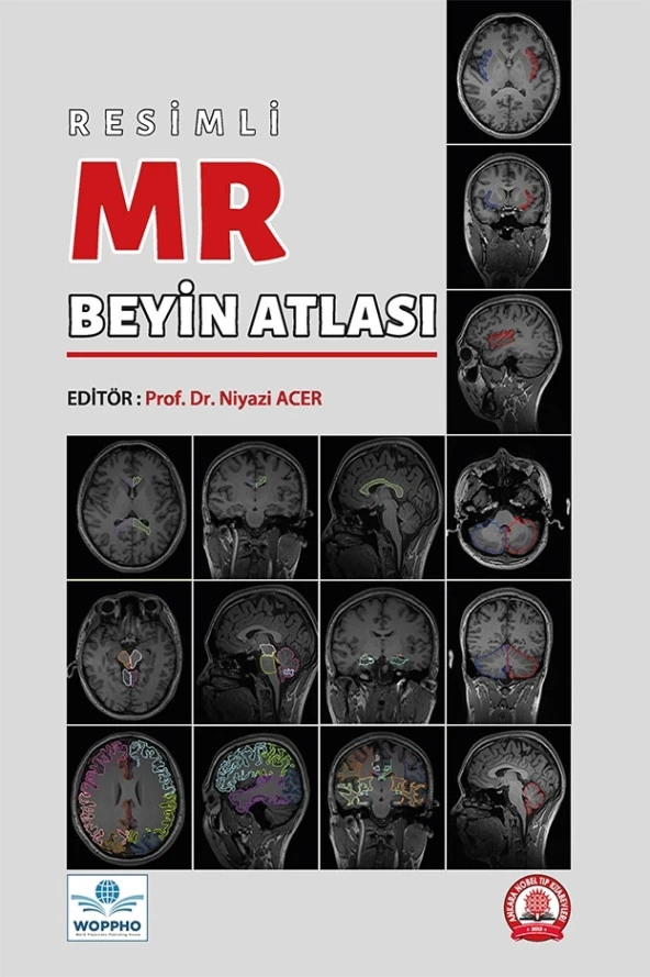 Resimli MR Beyin Atlası