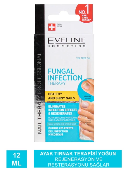 Eveline Fungal Infection Therapy - Ayak Tırnak Terapisi - 12 ml