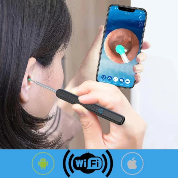 Valkyrie Kablosuz Wifi Kulak Temizleme Kamerası - Ios Android Iphone Uyumlu 1296P HD LED Otoskop Kamera - 3