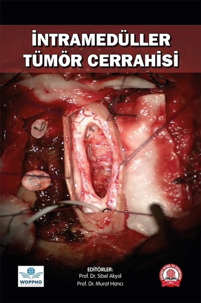 İntramedüller Tümör Cerrahisi ürün görseli 1