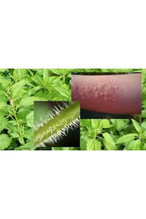 100 Adet Tohum Nadir Bulunan Isırgan Otu Tohumu - Resim 4