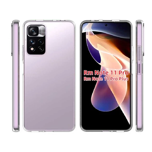 Xiaomi Redmi Note 11 Pro Plus 5G Kılıf Şeffaf Silikon Hibrit Case Kapak