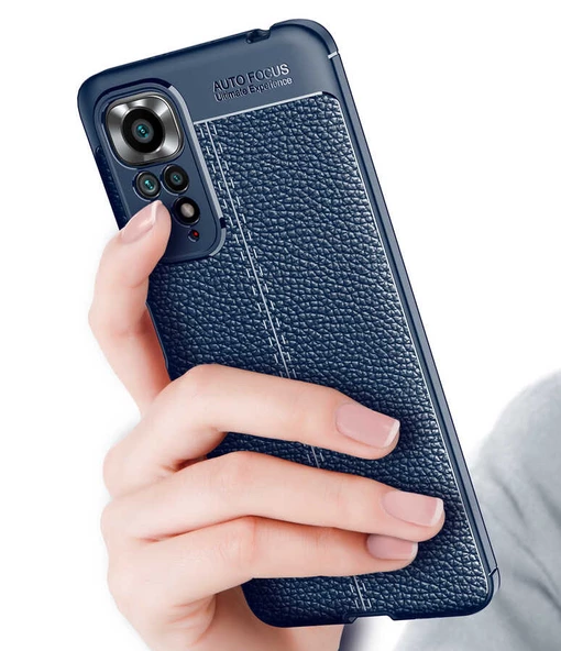 Xiaomi Redmi Note 11 Global Kılıf Deri Tarzı Niss Silikon Case Kapak - 2