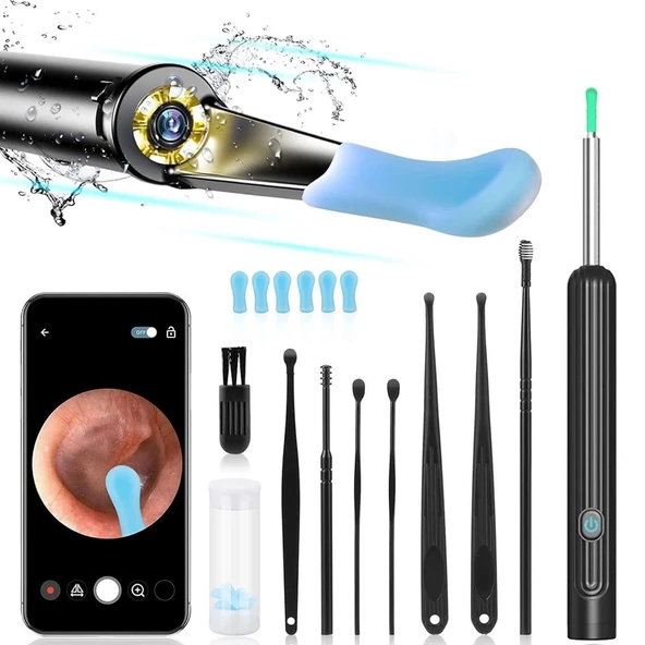 Pm-24065 Endoskop Kameralı Kulak Temizleme Cihazı All-ın-one Set - 2