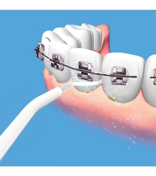 Portatif Tasarım Power Floss Mekanik Diş Ve Ağız Temizleme Aleti - 5