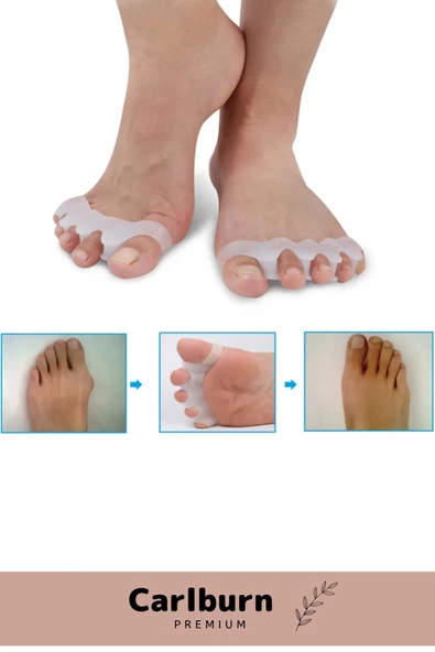 Kemik Büyümesi Karşıtı Şekil Bozukluğu Önleyici Ayak 5 Parmak Ayıran Silikon Bunyon Ayırıcı 2'li Set - 5
