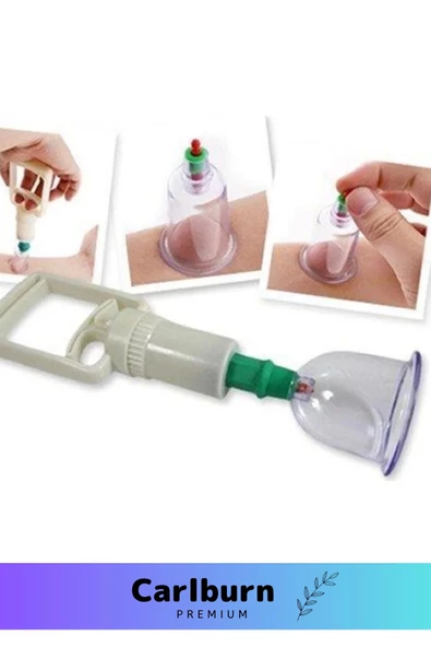 Premium Series Selülit Çatlak Giderici Vakumlu Masaj Aleti 36'lı Kupa Hacamat Seti - 4