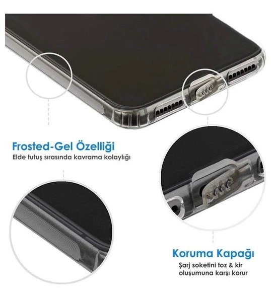 İphone X Şeffaf Tıpalı Kamera Korumalı Silikon Kılıf - 2
