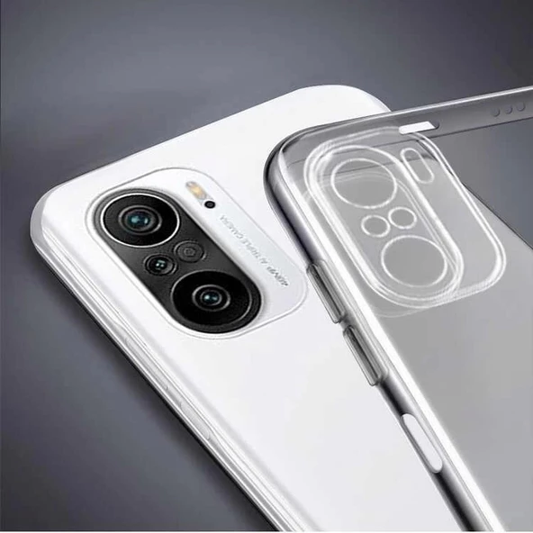 Xiaomi Redmi Note 10S- Redmi Note 10 4G Tıpalı Kamera Korumalı Şeffaf Silikon Kılıf - Resim 3