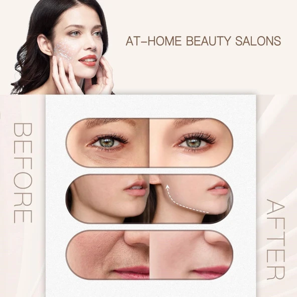 LEFAY Radyo Frekanslı Yüz Makinesi - Evde Yaşlanma Karşıtı Cilt Sıkılaştırma - 3