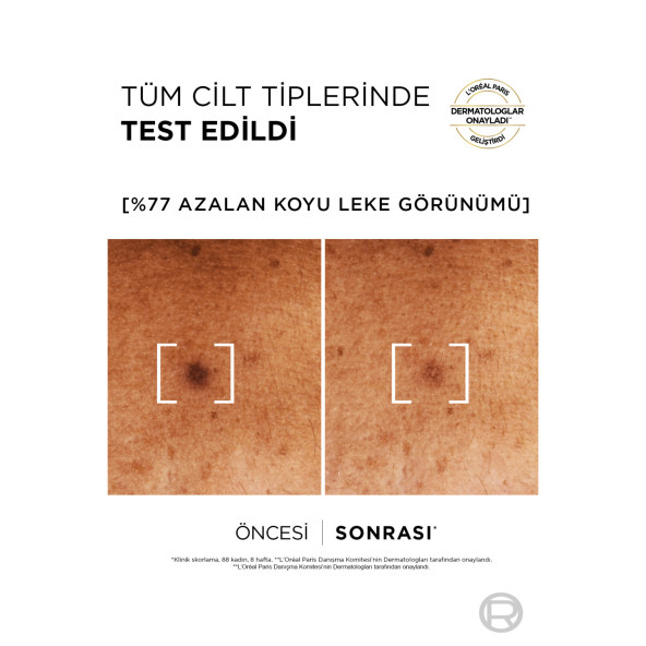 L'oreal Paris Bright Reveal Sivilce, Güneş, Yaşlanma Lekelerinde Etkili Koyu Leke Karşıtı Serum 10% Niasinamid - 5