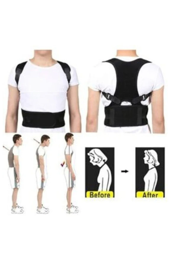 Dik Duruş Korsesi Erkek Kadın Kamburluk Önleyici Korse Dik Durmak Için Spor Korse Kifoz Korsesi - 2