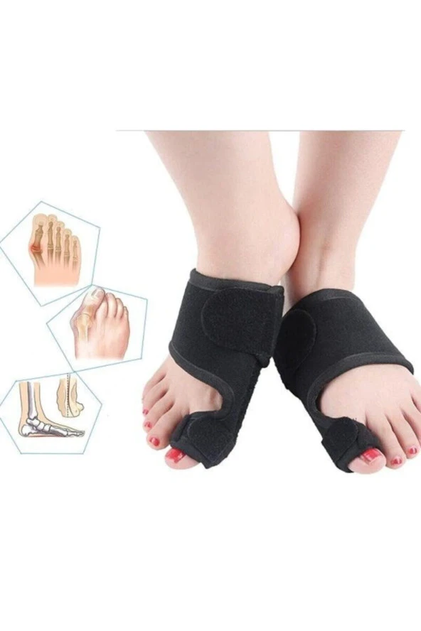 Metal Destekli Ayak Baş Parmak Kemik Bunyon Koruyucu Bunion Halluks Valgus Set Başparmak Geçen Atel - 6