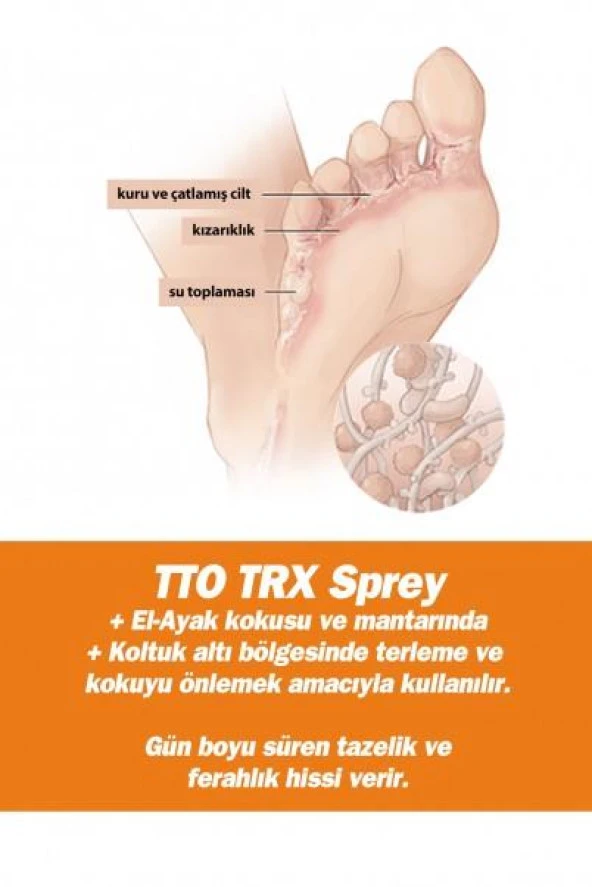 Tto Thermal Terex Ter Önleyici Sprey 50 Ml - Resim 3