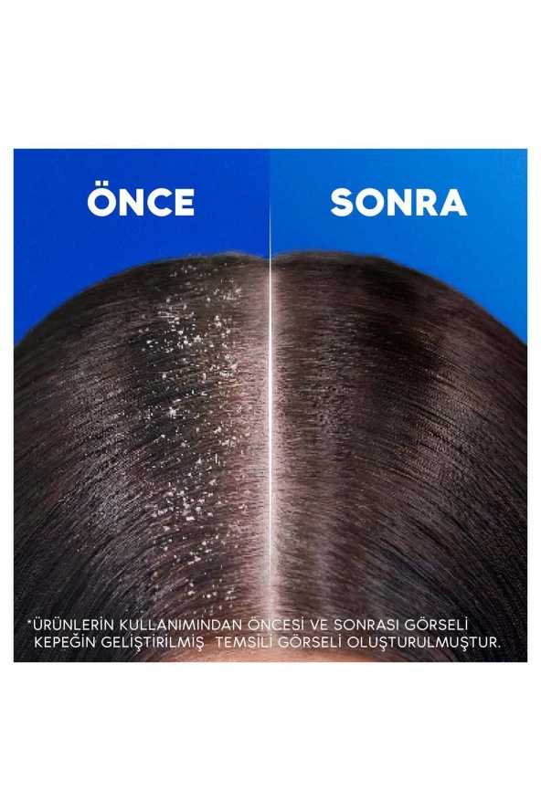 Head And Shoulders Şampuan Derinlemesine Nemlendir - 3