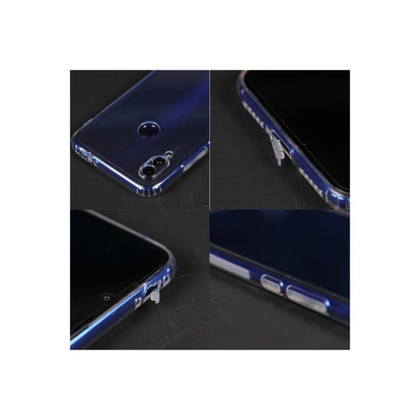 Xiaomi Redmi Note 7 Pro Kılıf Şeffaf Silikon Kamera Korumalı 3D Tıpalı - 2