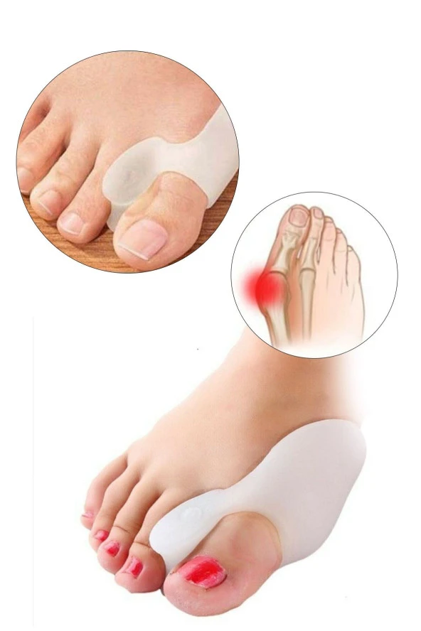 Silikon Makaralı Ayak Baş Parmak Kemik Bunyon Koruyucu Halluks Valgus Set