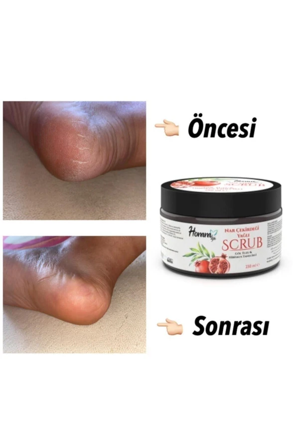 Nar Çekirdeği Yağlı Bitki Tanecikli Scrub 250 Ml-narlı Scrub - Resim 2