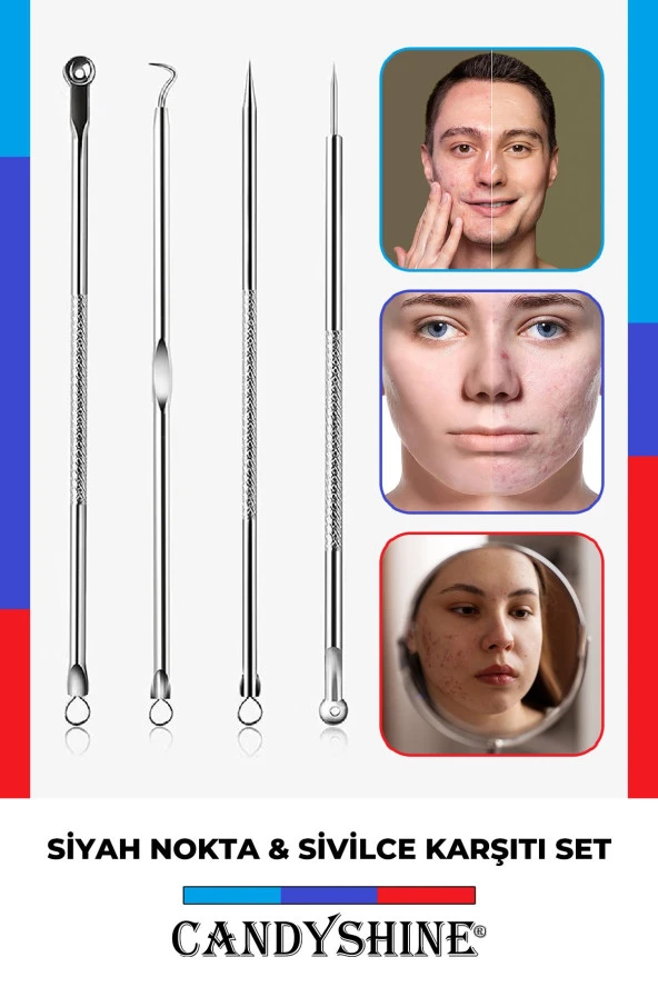 Hijyenik Kutulu Paslanmaz Çelik Sivilce Akne Siyah Nokta Temizleme Komedon Aleti 4 Parça - 3