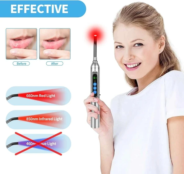 LONLIKE Kırmızı Işık Terapisi, Uçuk Tedavi Cihazı - 4