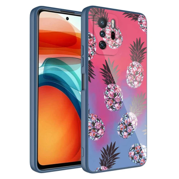 Xiaomi Redmi Note 10 Pro Kılıf Kamera Korumalı Bulut Desenli Sert Parlak Silikon Kapak (Epoksi)