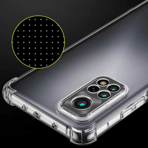 Xiaomi Redmi Note 11 Pro 5G Kılıf  Kamera Korumalı Nitro Anti Shock Silikon - 3