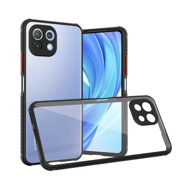 Xiaomi Mi 11 Lite Kılıf  Kaff Kapak - Resim 3