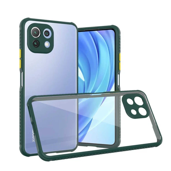 Xiaomi Mi 11 Lite Kılıf  Kaff Kapak - Resim 4
