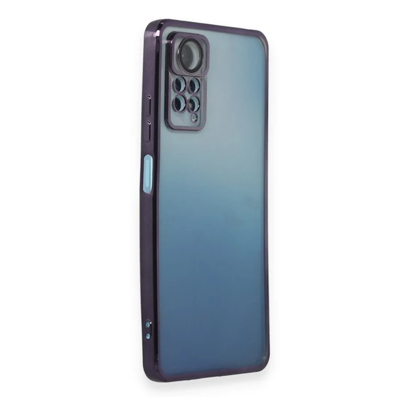 Xiaomi Redmi Note 11 / 11s Kılıf Razer Lens Çerçeveli Silikon Kapak - 6