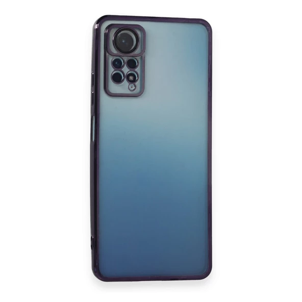 Xiaomi Redmi Note 11 / 11s Kılıf Razer Lens Çerçeveli Silikon Kapak - 5