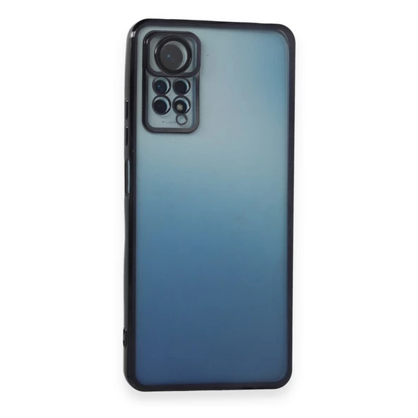 Xiaomi Redmi Note 11 / 11s Kılıf Razer Lens Çerçeveli Silikon Kapak - 8